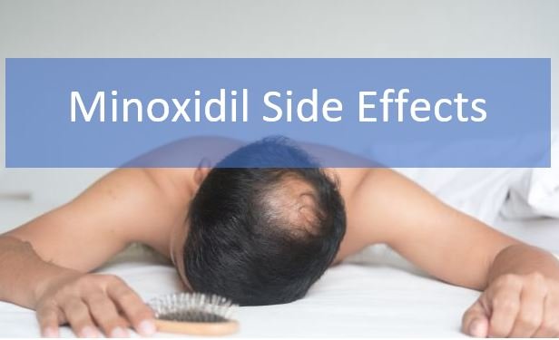 Minoxidil side effects